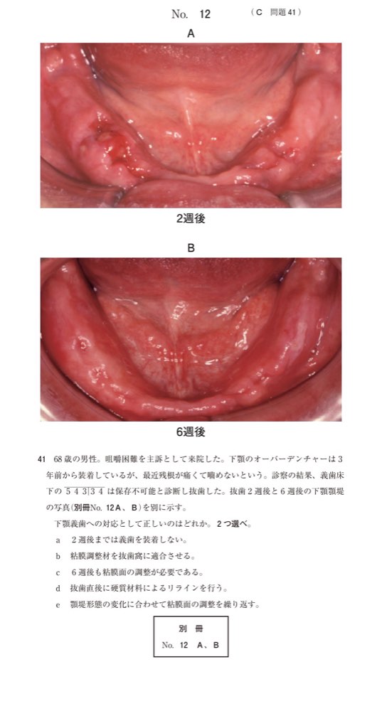 115C041の問題画像
