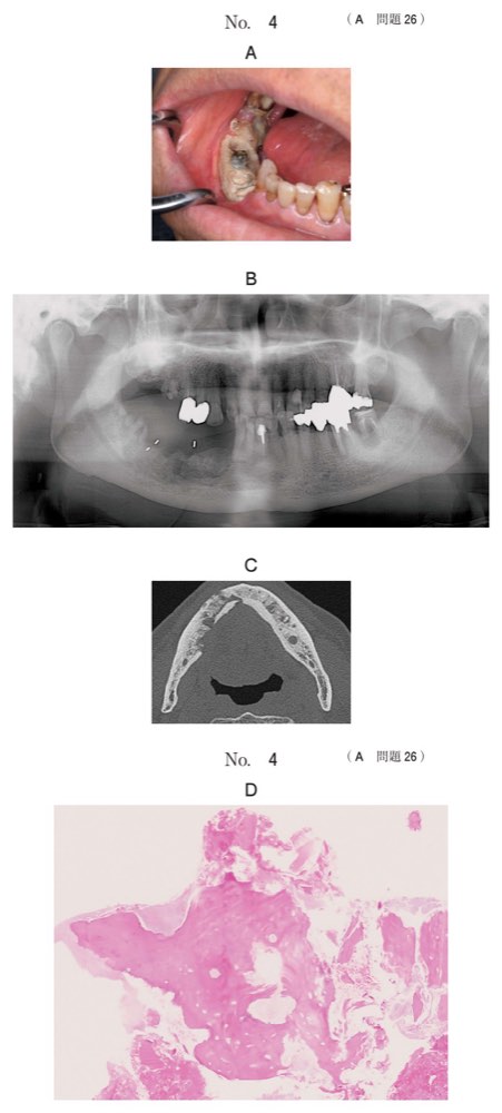 115A026の問題画像