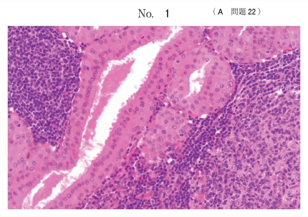 116A022の問題画像