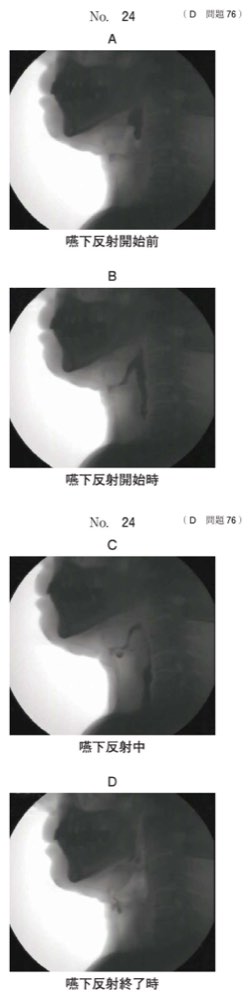 119D076の問題画像