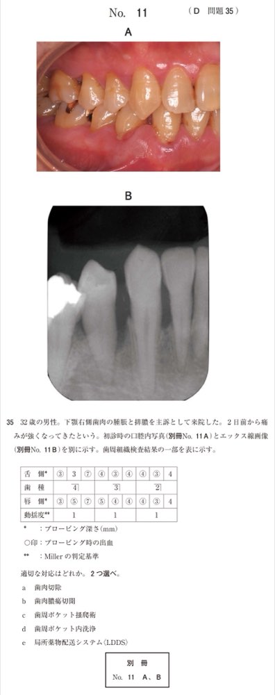 118D035の問題画像