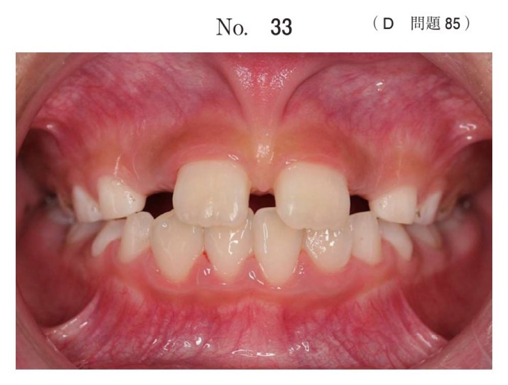 116D085の問題画像