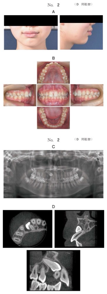 119D022の問題画像