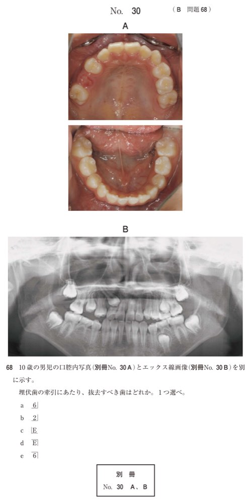115B068の問題画像