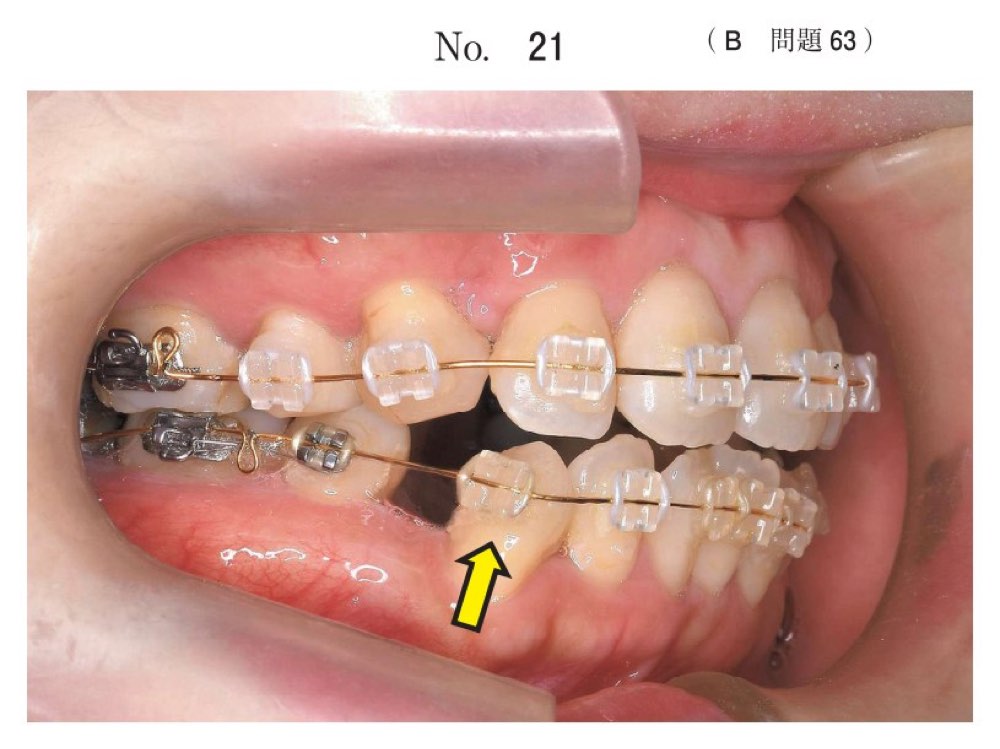 117B063の問題画像