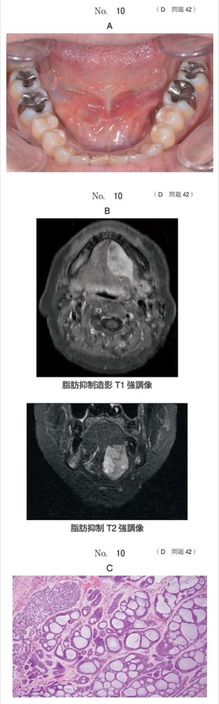 117D042の問題画像
