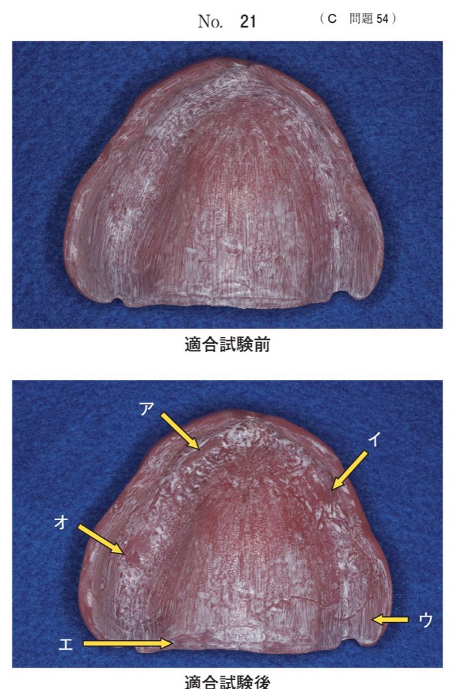 117C054の問題画像