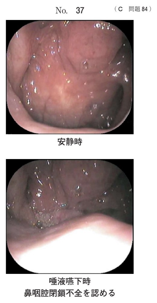 117C084の問題画像