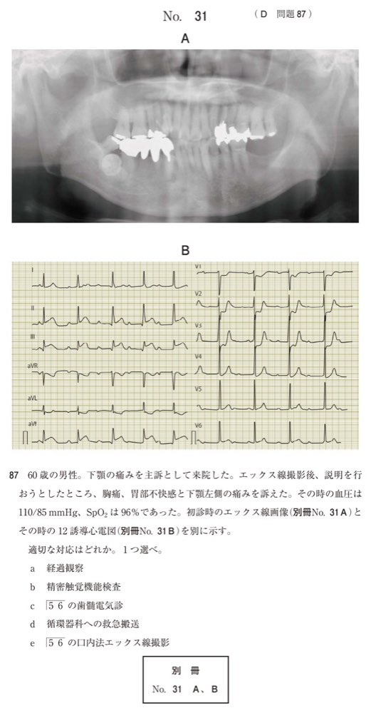 115D087の問題画像