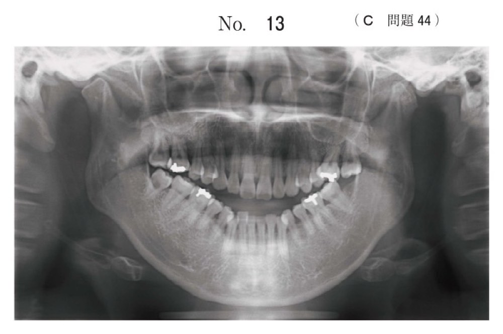 119C044の問題画像