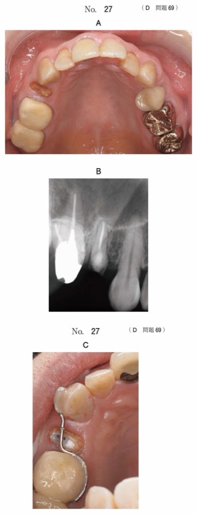 118D069の問題画像