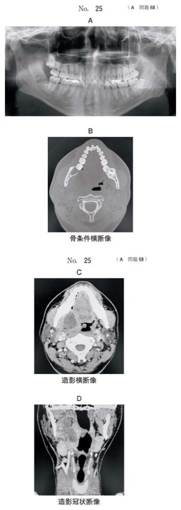 117A068の問題画像