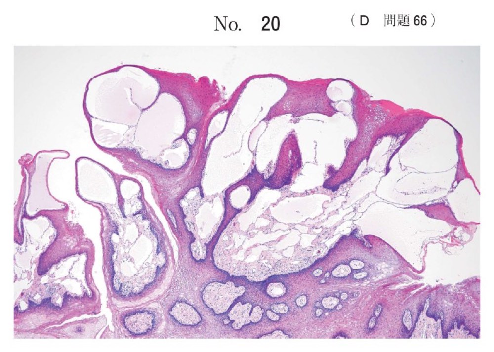115D066の問題画像