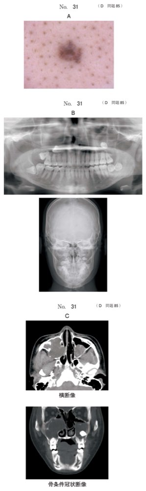 117D085の問題画像