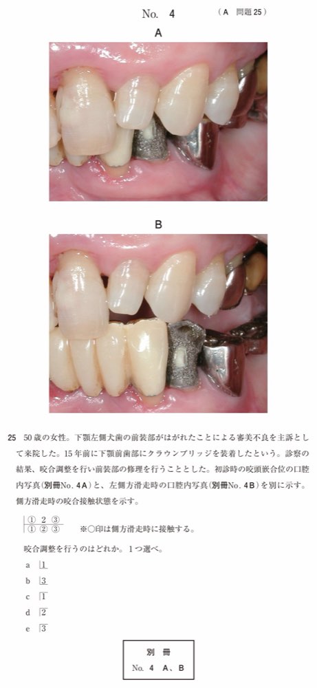 116A025の問題画像
