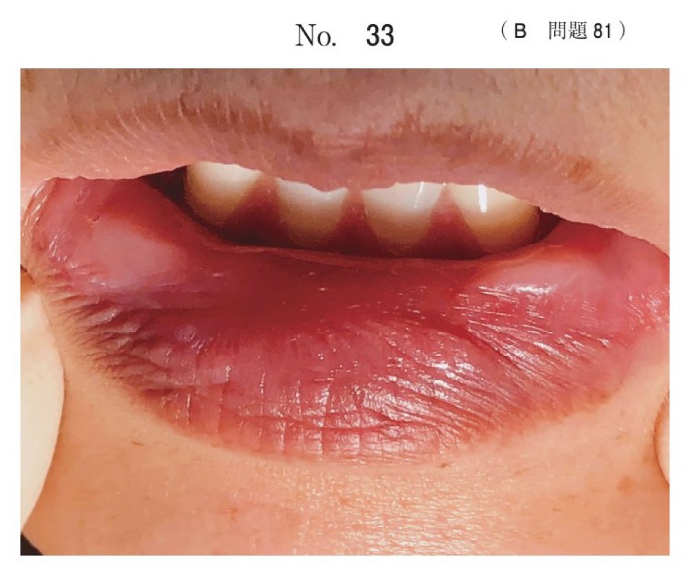 116B081の問題画像