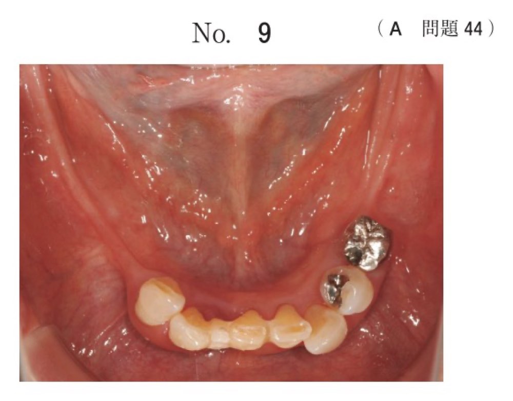 119A044の問題画像