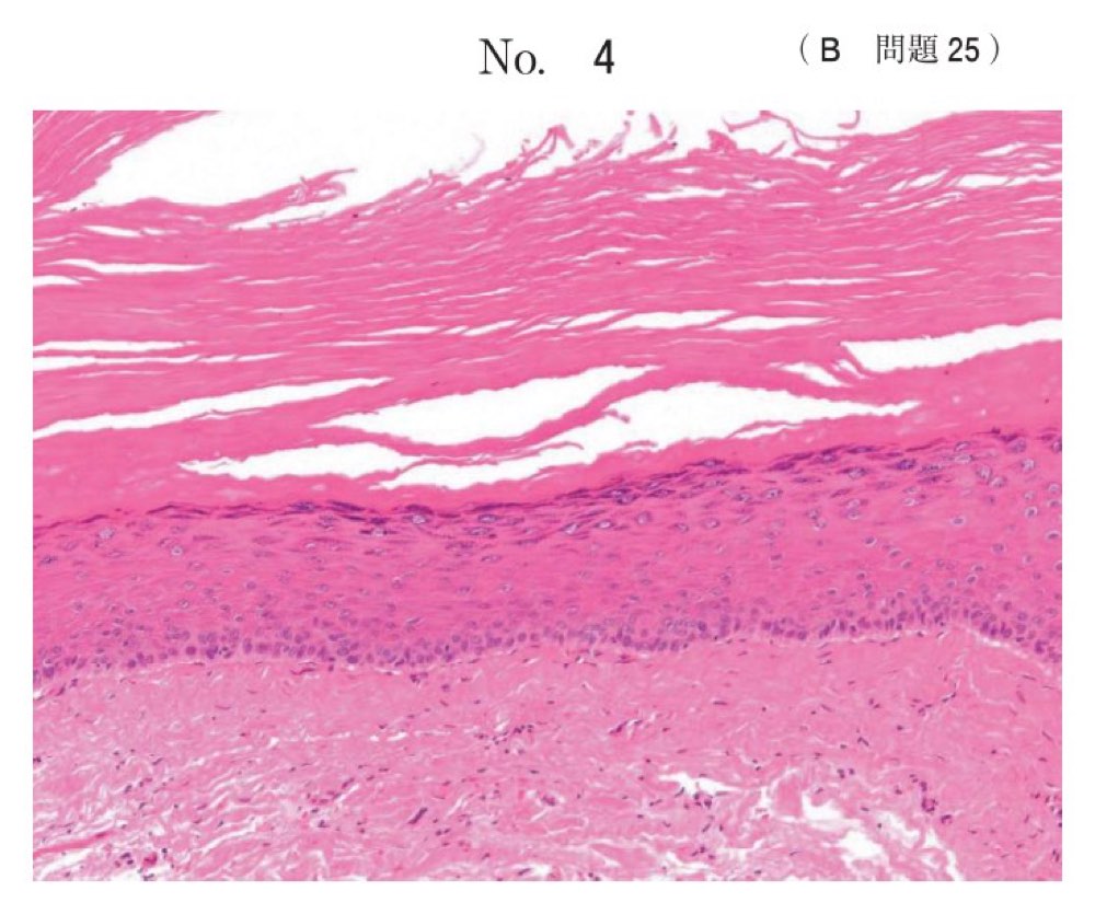 117B025の問題画像