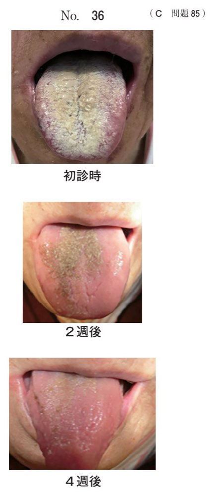 116C085の問題画像