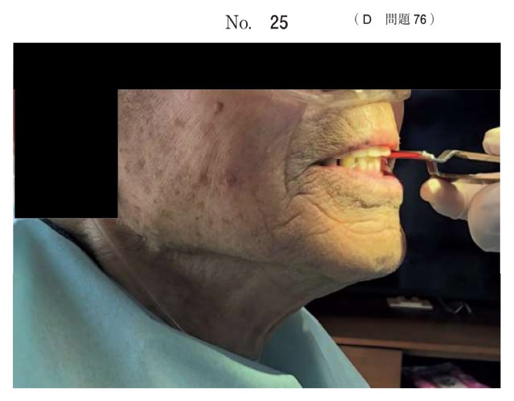 115D076の問題画像