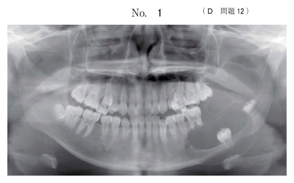 116D012の問題画像