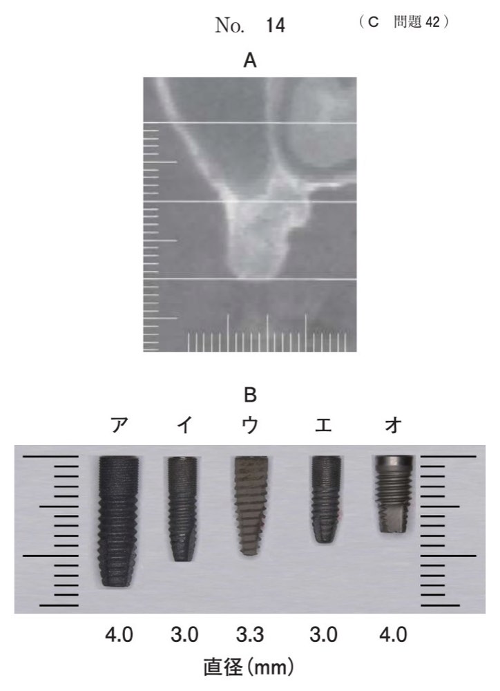 116C042の問題画像