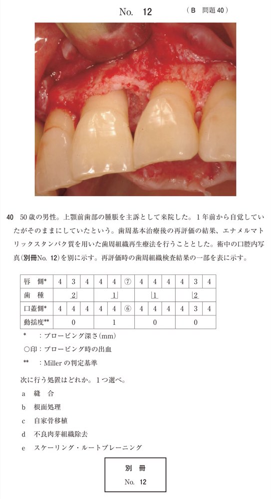 117B040の問題画像