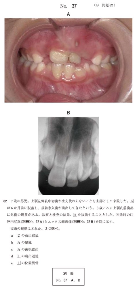 115B082の問題画像