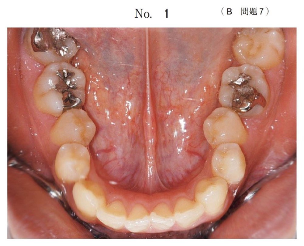 118B007の問題画像