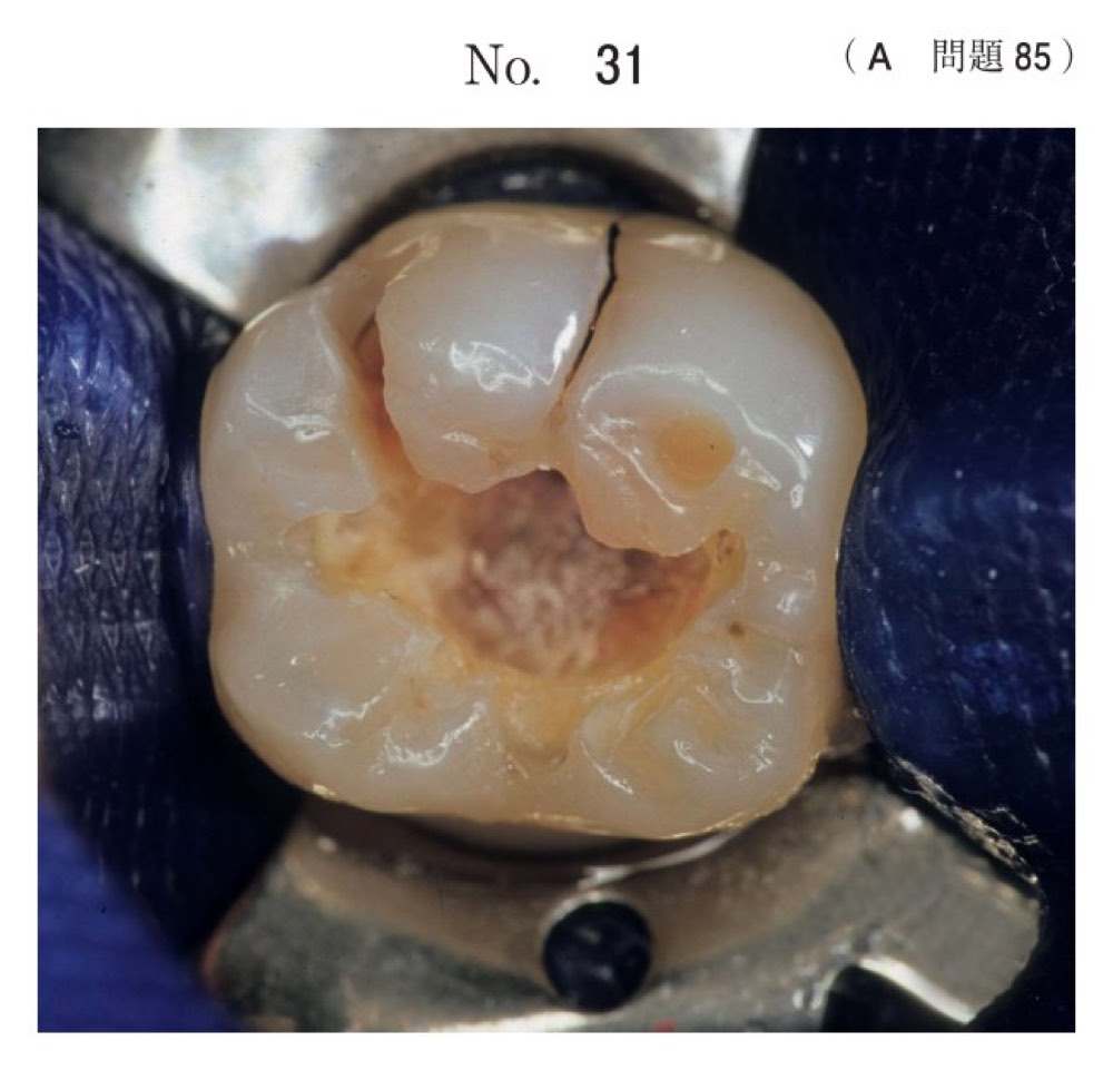 117A085の問題画像
