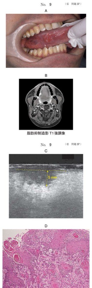115C037の問題画像