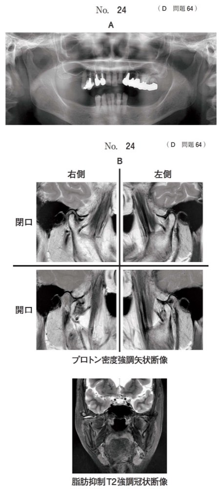 118D064の問題画像