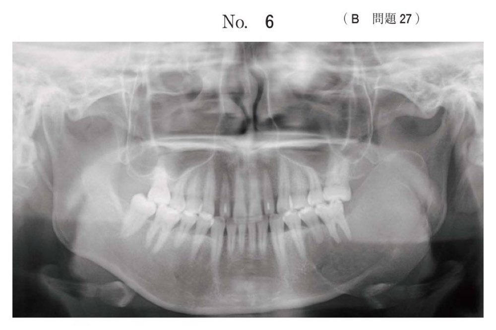 115B027の問題画像