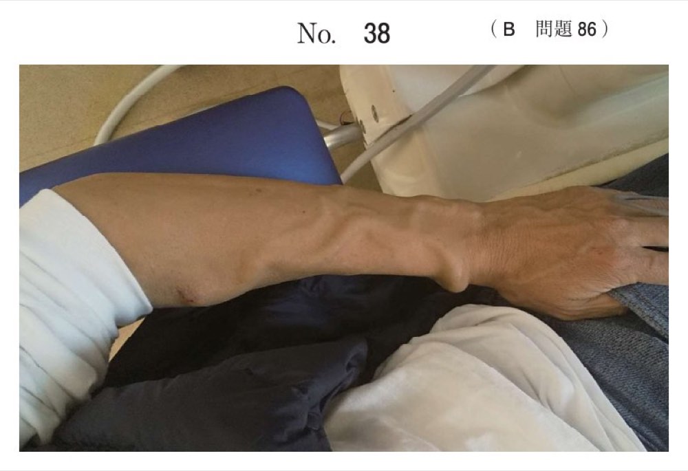 116B086の問題画像