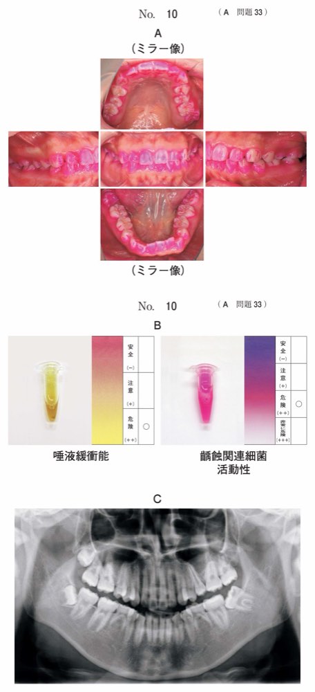 117A033の問題画像