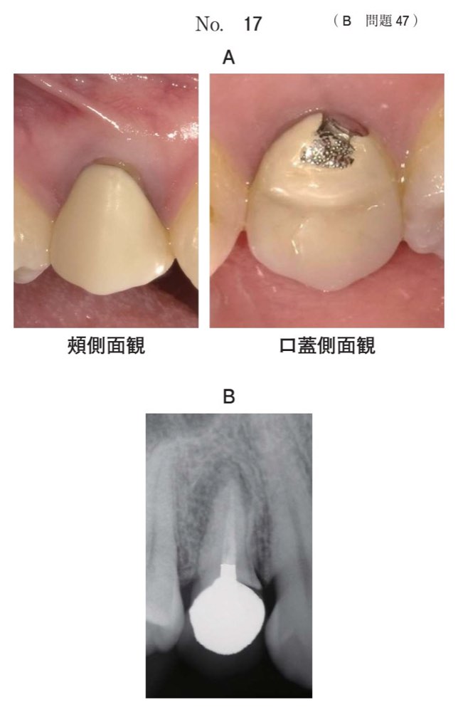 116B047の問題画像