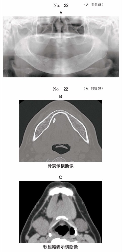 117A058の問題画像