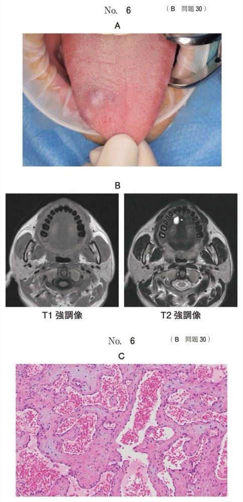 118B030の問題画像