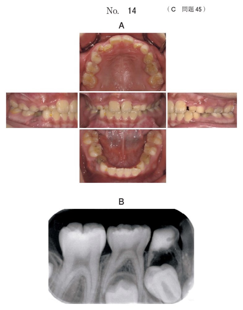 117C045の問題画像