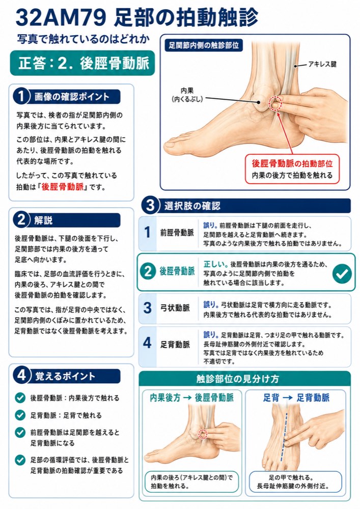 32AM79の解説画像