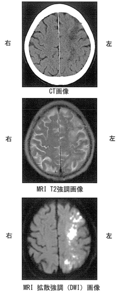 34PM15の問題画像