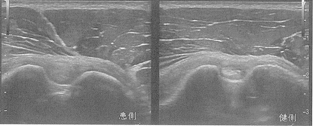 33PM113の問題画像
