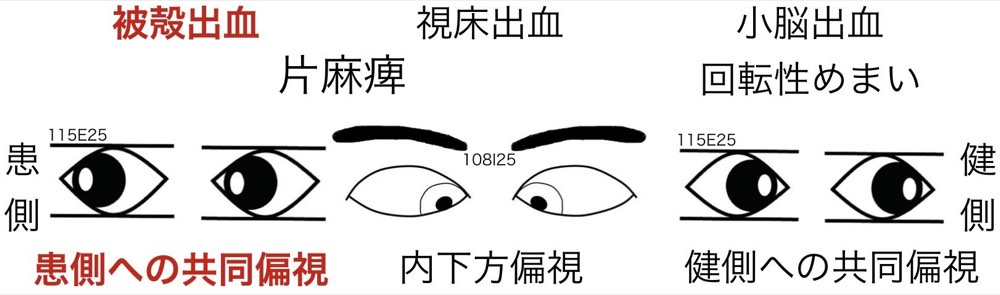 119A3の解説画像