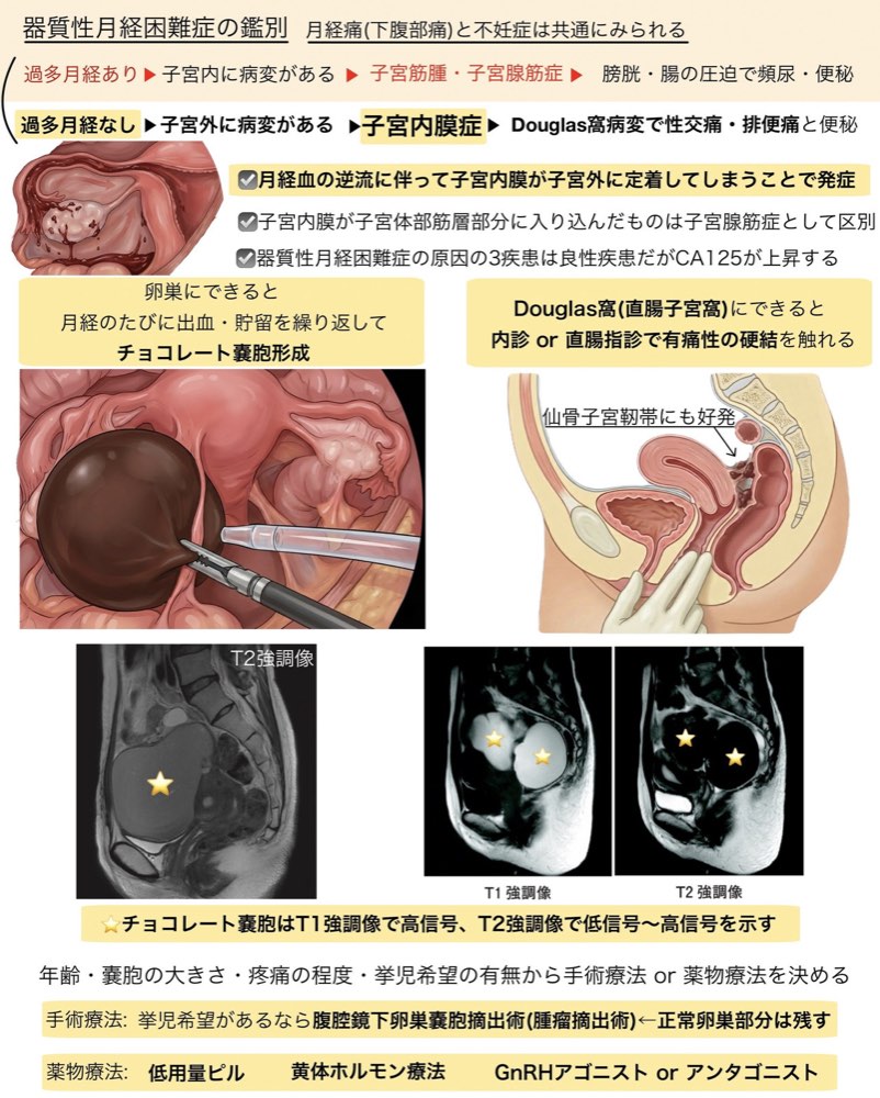 115B9の解説画像