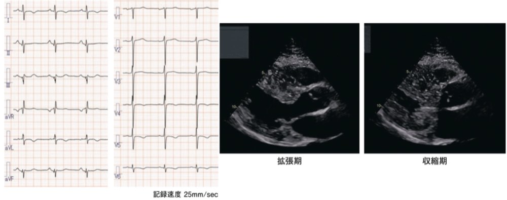118D31の問題画像