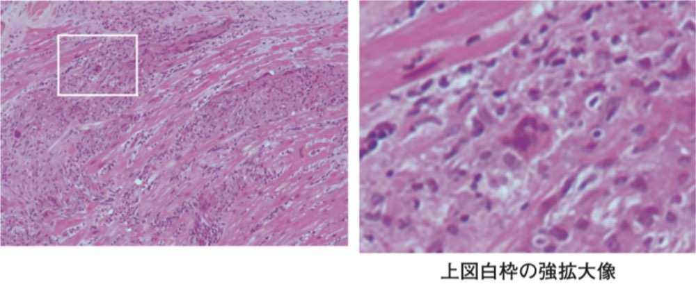 118D53の問題画像