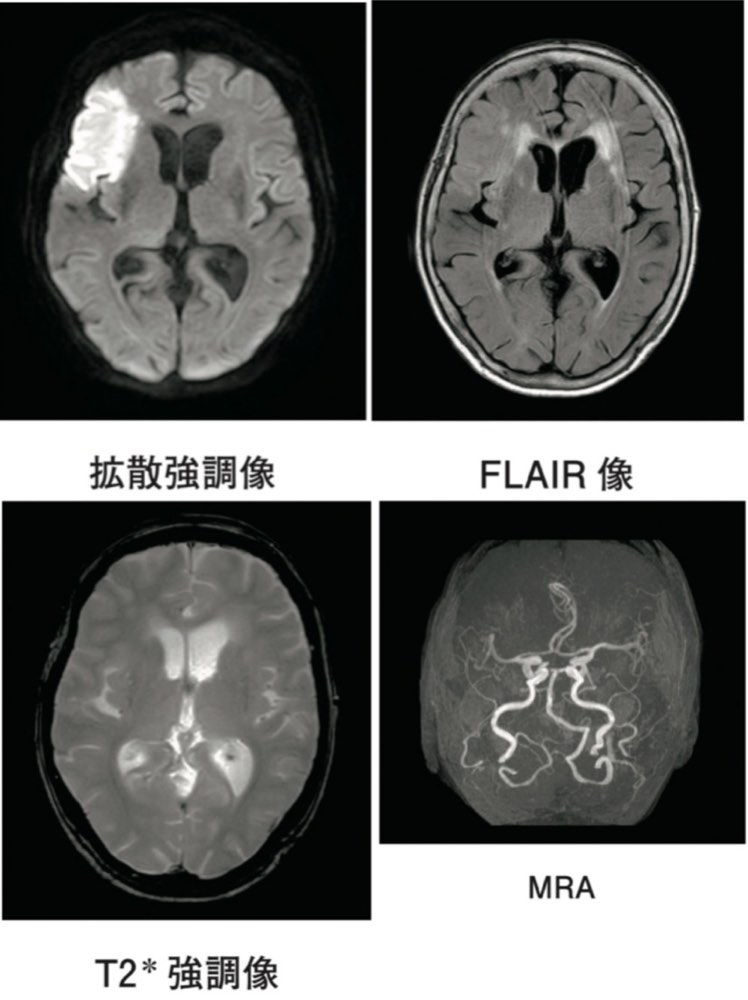 115A58の問題画像