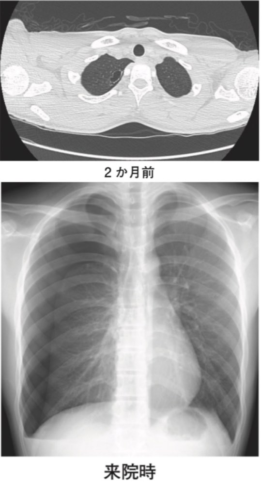 116E43の問題画像