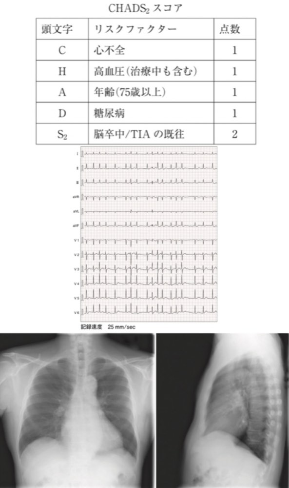 116E45の問題画像