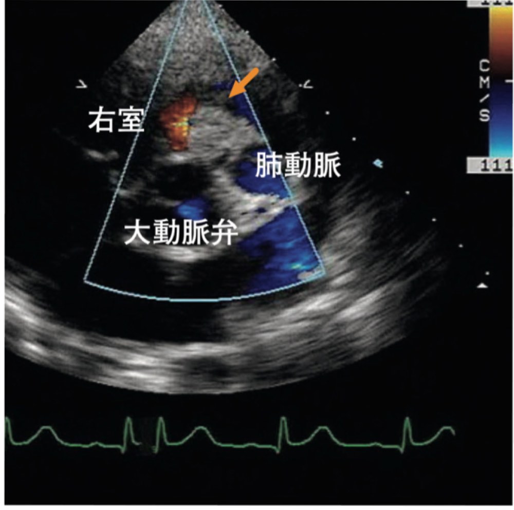 117A68の問題画像